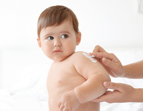 Why Topical Remedies Work For Eczema Rashes