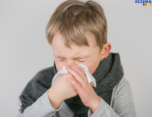 Natural Cold Treatments for Kids with Eczema