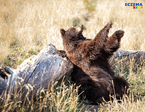 Why Is My Child Still So Itchy? - eczemakids.com