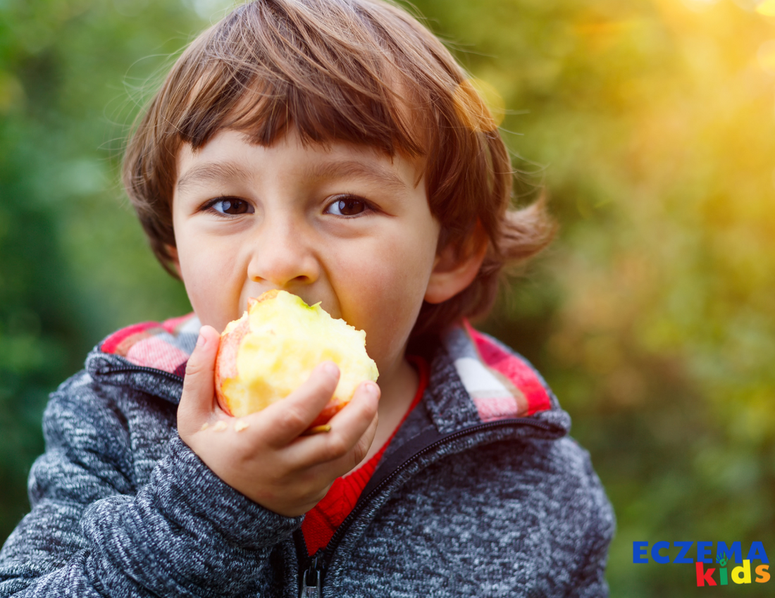 Best Foods for Eczema