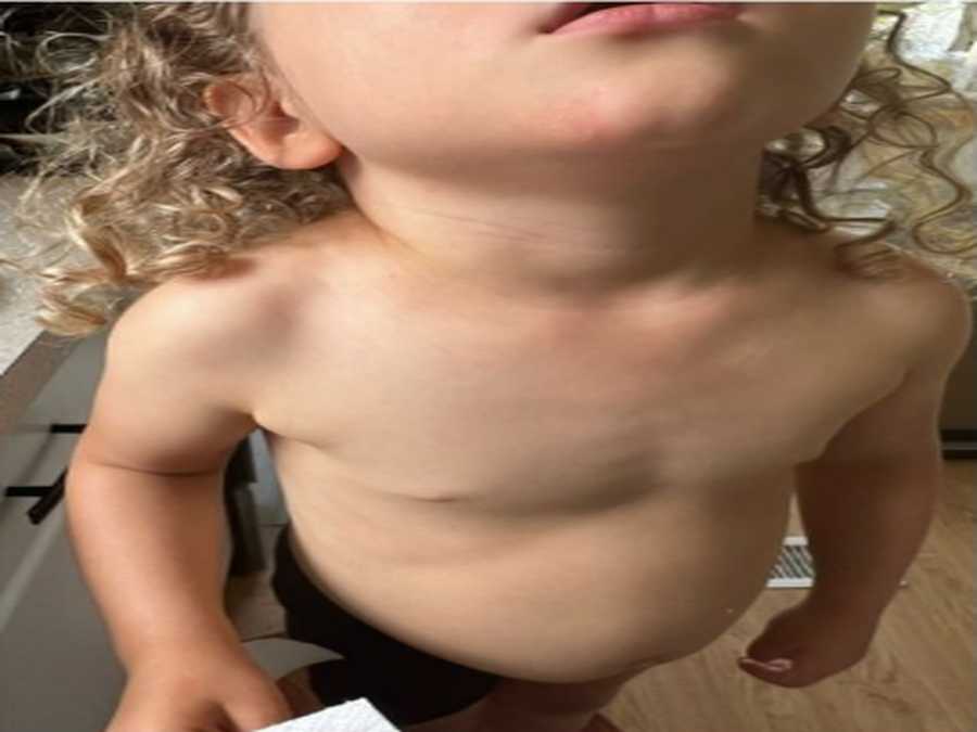 After image