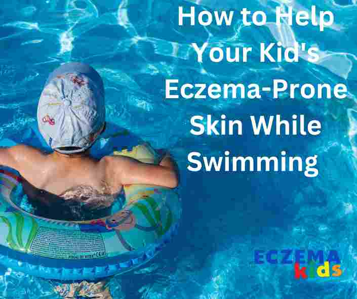 swimming and eczema