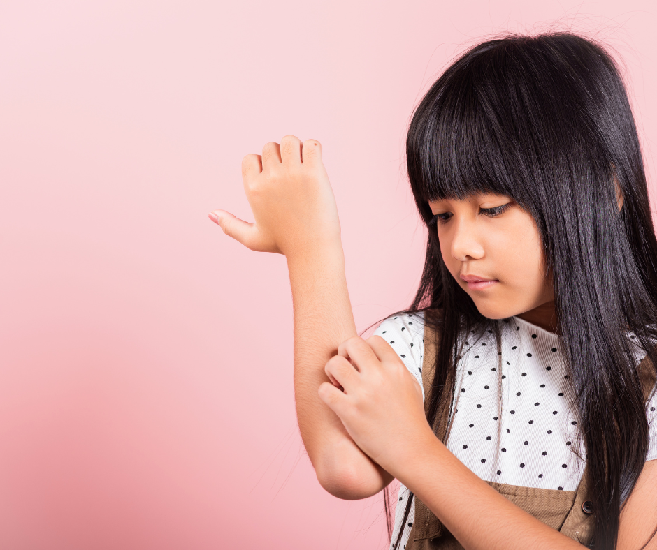how to stop your child from itching eczema rashes