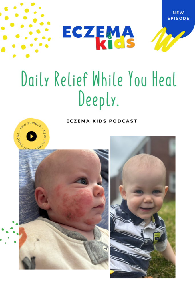 eczema itch